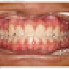 Braces N Faces Orthodontics