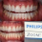 Burleigh Dentistry & Implants: Burleigh Heads