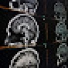 City Xray - Martin Place