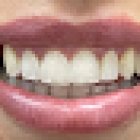 Falkirk Dental Care | Invisalign |Composite Bonding| Bespoke Dentures| Implants| Multi Award Winning Lifestyle Clinic