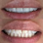 M Dental Canada Water