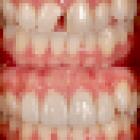 Advanced Dental Care Lakewood