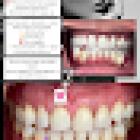 American Family Dental Care - Falls Church