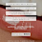 Dental Vallès / Implantes, Ortodoncia Invisible, Estética, urgencias