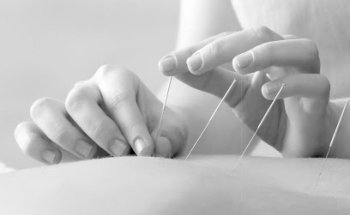 BodyQi TCM Praxis; Chinesische Medizin, Akupunktur, Personal Training, Fitness, Medizinische Massagen, Schröpfen