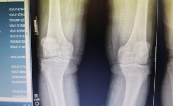 The Fitness Center - Valley Medical Center