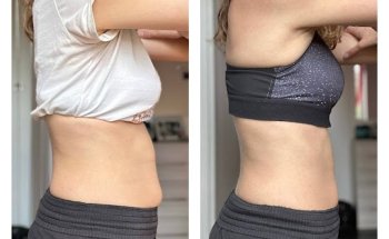 Secret-Laura Russo Nutricionista en Madrid