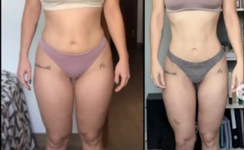 Tamara Nutrición Marbella