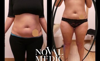 Novalmedic