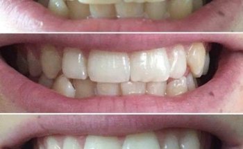 Prisila Nutrición y Cosmética - Omnilife, Seytú