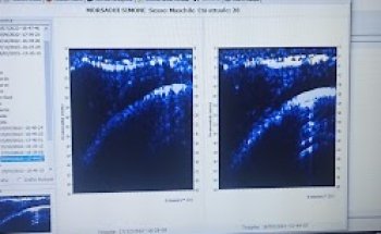 Dott. Rocco Cristaudo Nutrizionista