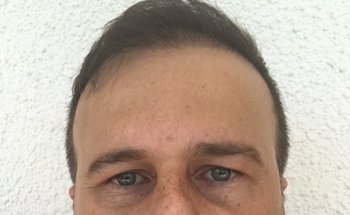 Nutrizionista Roma a Piazza Bologna Alberto Dott. Buttari Zona Sapienza Piazzale Province Parioli