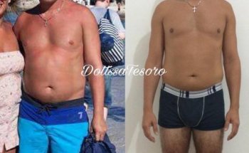 Dott.ssa Clara Tesoro, Nutrizionista