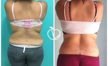 Nutriólogo en Colima Daniel Prado Q. (Nutrición Clínica)