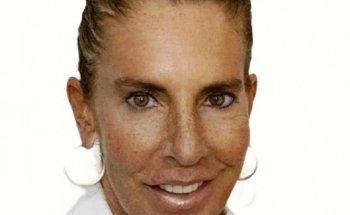 Dra. Carol Wainstein Gewolb, Nutriólogo