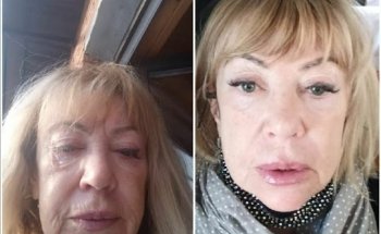 Die Nutrition Academy