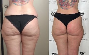 HEBE ESTETIC | Nereida Gallardo