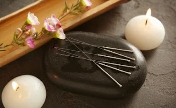 Acupuntura y Medicina Tradicional China (MTC) Dr. Vicent Pardo