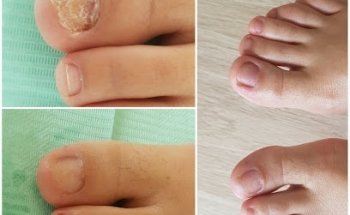 CLINICA PODOLOGICA NOJA