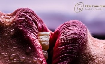 Oral Care Clinic - Medicina Dentária (Águas Santas - Maia)