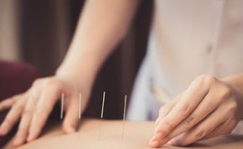 Wellness Acupuncture by Oksana Gryvnak, R.TCMP, R.Ac