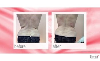 New Age Laser Clinic