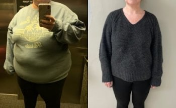 Arch Bariatrics: Kumaran Chinnappan, MD, FACS: Bariatric Weight Loss Surgery