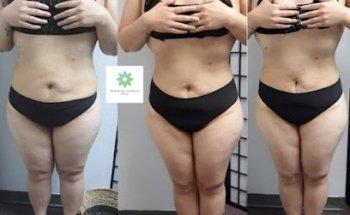 Natural Wellness & Beauty LLC | Lymphatic Drainage Post Op| Massage I Facials