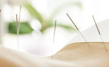 Jing Fang Li, MD, OMD, LAc Acupuncture