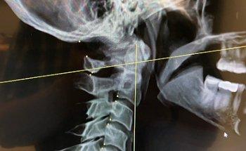 McKinzie Chiropractic & Nutrition