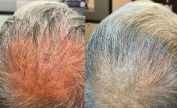 Circadian Rejuvenation