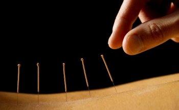 HealthWorks Physiotherapy Massage Therapy & Acupuncture