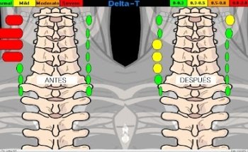 Quiropràctic Vertebral - Manresa