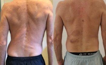 Massage & Sports Manual Therapist SMT®