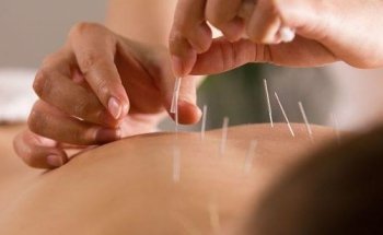 Fisioterapia Corretiva