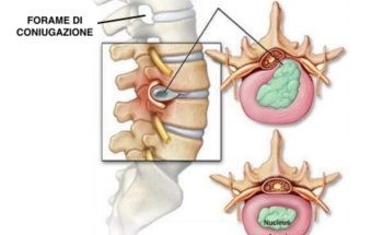 Osteopata Melfi Dott.ssa Laurenziello