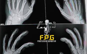 Fisio Pie Grande