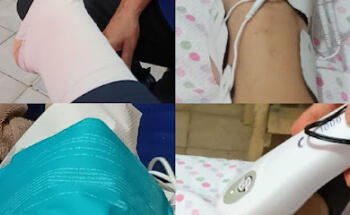 Fisioterapia y bienestar