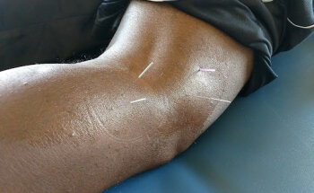 PT Center For Sports Medicine