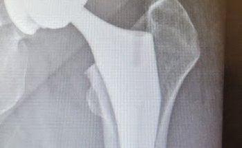 BoulderCentre for Orthopedics & Spine