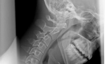 Carson Family Chiropractic