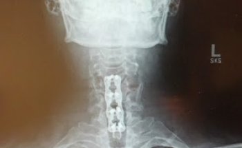 Center For Orthopedics