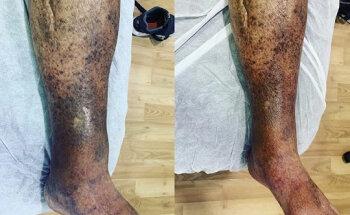 Fisiosalud+ Alcobendas