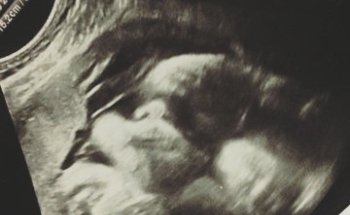 Mission Hospital Outpatient