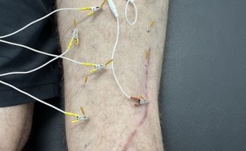 Revive Physiotherapy