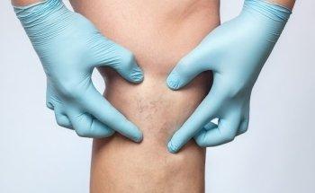 Fisioterapia Lugano Domicilio