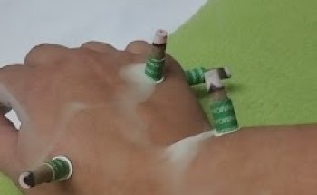 ACUPUNTURA PUERTO VARAS